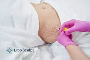 Do you want to know how long Aqualyx Malvern Common results last?