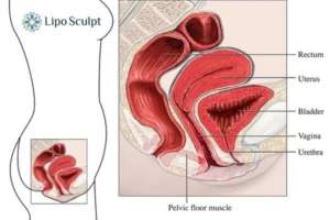 How EM Chair treatment Malvern Common can help Leaky bladder issues. Read more now!