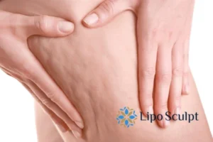 Start your journey today book your coolsculpting treatment Malvern Common online today!
